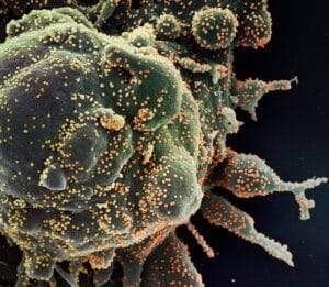 Cáncer crónico: la revolución médica que cambia el enfoque del tratamiento